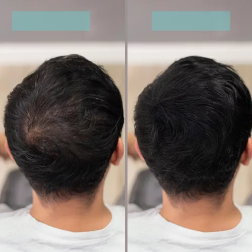 TCR Keratin Fiber - 2in1 hajépítő keratin szál és hajdúsító por - auburn/vörös 2,5g