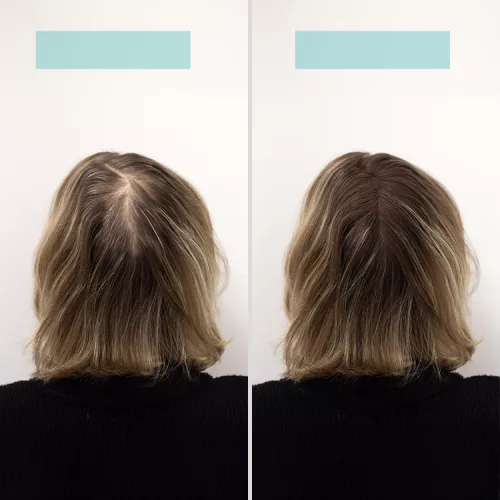 TCR Keratin Fiber - 2in1 hajépítő keratin szál és hajdúsító por - black/fekete 25g