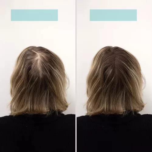TCR Keratin Fiber - 2in1 hajépítő keratin szál és hajdúsító por - white/fehér 2,5g