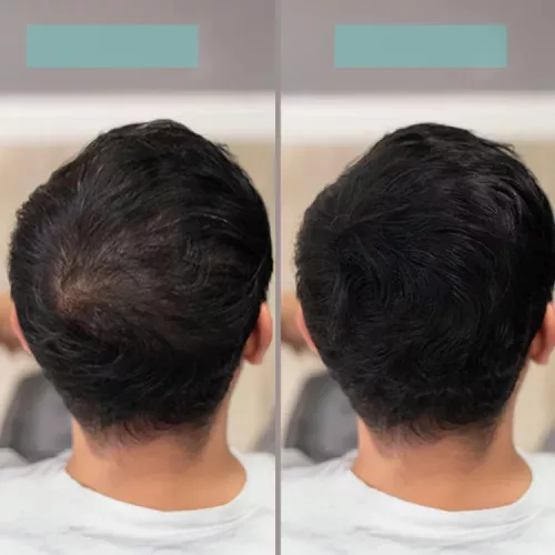 TCR Keratin Fiber - 2in1 hajépítő keratin szál és hajdúsító por - grey/szürke 25g
